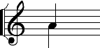 \begin{figure}\begin{center}
\includegraphics{insertion2.eps}
\end{center}\end{figure}